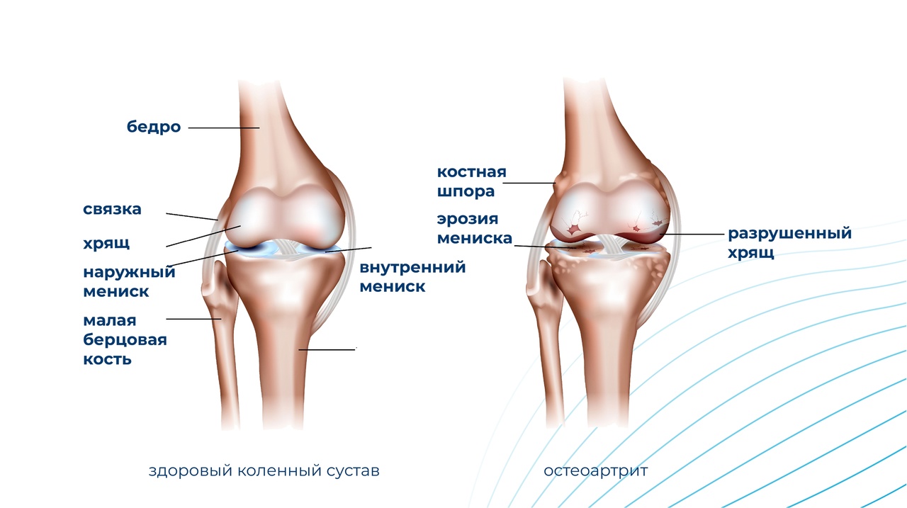 Если больно преклонять колени